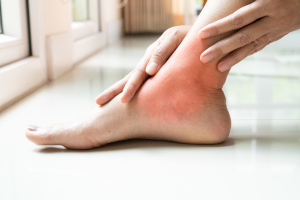 Ankle Injury and Pain